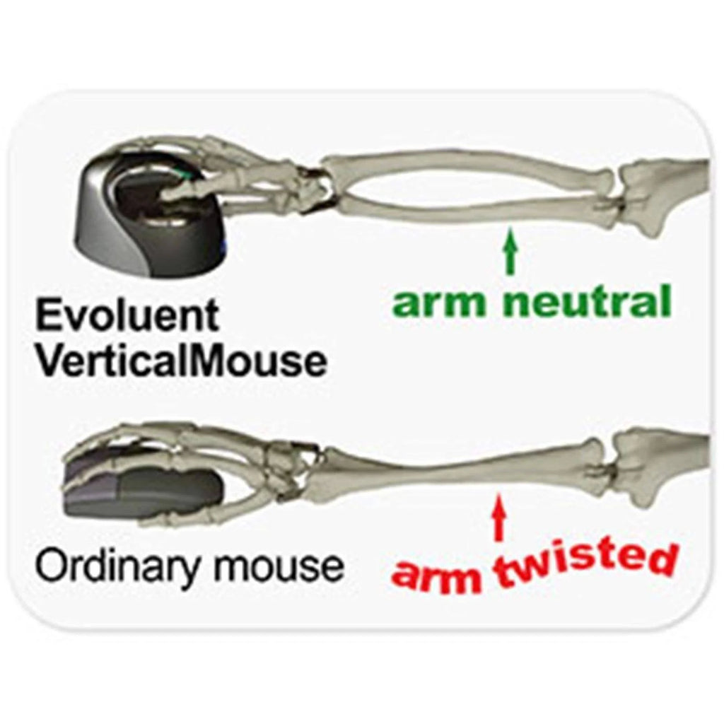 VerticalMouse 4 Right Mouse F471415